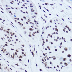 Lupus La Protein (SSB) Antibody