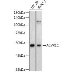 Activin A Receptor Type 1C (ACVR1C) Antibody