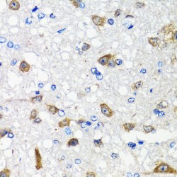 Activin A Receptor Type 1C (ACVR1C) Antibody