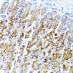 Activin A Receptor Type 1C (ACVR1C) Antibody