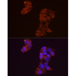 Fibroblast Growth Factor 1, Acidic / AFGF (FGF1) Antibody