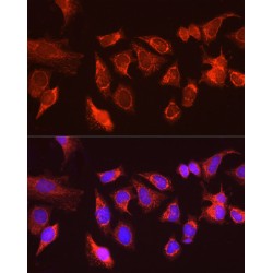 Autophagy-Related Protein 13 (ATG13) Antibody