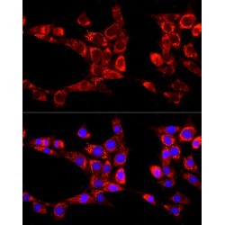 Autophagy-Related Protein 13 (ATG13) Antibody