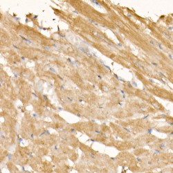 Suppressors of Cytokine Signaling 3 (SOCS3) Antibody