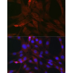 Suppressors of Cytokine Signaling 3 (SOCS3) Antibody