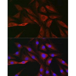 Suppressors of Cytokine Signaling 3 (SOCS3) Antibody