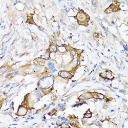 Matrix Metalloproteinase-7 (MMP7) Antibody