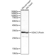 Western blot analysis of various lysates using VDAC1 / Porin Antibody at 1/400 dilution. Secondary antibody: HRP-conjugated Goat anti-Rabbit IgG (H+L) at 1/10000 dilution. Lysates/proteins: 25 µg per lane. Blocking buffer: 3% nonfat dry milk in TBST. Exposure time: 1s.