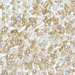 Voltage-Dependent Anion-Selective Channel Protein 1 (VDAC1) Antibody