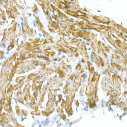 Voltage-Dependent Anion-Selective Channel Protein 1 (VDAC1) Antibody