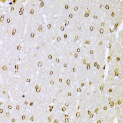 X-Ray Repair Cross Complementing 6 (XRCC6) Antibody