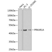 Western blot analysis of various lysates using [KO Validated] PRKAR1A Antibody at 1/1000 dilution. Secondary antibody: HRP-conjugated Goat anti-Rabbit IgG (H+L) at 1/10000 dilution. Lysates/proteins: 25 µg per lane. Blocking buffer: 3% nonfat dry milk in TBST.