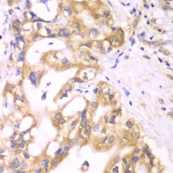 Acyl-CoA Dehydrogenase, C-2 To C-3 Short Chain (ACADS) Antibody