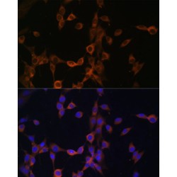 Calcineurin Subunit B Type 1 (PPP3R1) Antibody