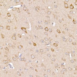 TNF Receptor Associated Factor 2 (TRAF2) Antibody