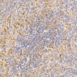 TNF Receptor Associated Factor 2 (TRAF2) Antibody
