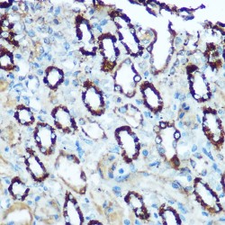 Heat Shock 60 kDa Protein 1, Chaperonin / HSP60 (HSPD1) Antibody