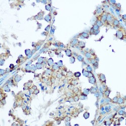 Heat Shock 60 kDa Protein 1, Chaperonin / HSP60 (HSPD1) Antibody