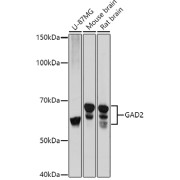 Western blot analysis of various lysates using GAD65/GAD2 Antibody at 1/1000 dilution. Secondary antibody: HRP-conjugated Goat anti-Rabbit IgG (H+L) at 1/10000 dilution. Lysates/proteins: 25 µg per lane. Blocking buffer: 3% nonfat dry milk in TBST. Exposure time: 5s.