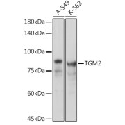 Western blot analysis of various lysates using Transglutaminase 2 (TGM2) Antibody at 1/1000 dilution. Secondary antibody: HRP-conjugated Goat anti-Rabbit IgG (H+L) at 1/10000 dilution. Lysates/proteins: 25 µg per lane. Blocking buffer: 3% nonfat dry milk in TBST. Exposure time: 10s.