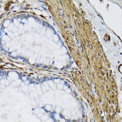 Protein-Glutamine Gamma-Glutamyltransferase 2 (TGM2) Antibody