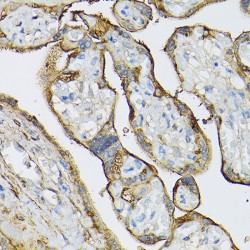 Protein-Glutamine Gamma-Glutamyltransferase 2 (TGM2) Antibody