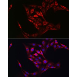 Protein-Glutamine Gamma-Glutamyltransferase 2 (TGM2) Antibody