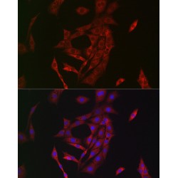 Protein-Glutamine Gamma-Glutamyltransferase 2 (TGM2) Antibody