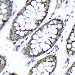 Hexokinase 2 (HK2) Antibody