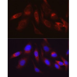 Hexokinase 2 (HK2) Antibody