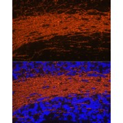 Western blot analysis of various lysates using CNPase Antibody at 1/1000 dilution. Secondary antibody: HRP-conjugated Goat anti-Rabbit IgG (H+L) at 1/10000 dilution. Lysates / proteins: 25 µg per lane. Blocking buffer: 3 % nonfat dry milk in TBST. Detection: ECL Basic Kit (RM00020). Exposure time: 1s.