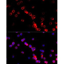 Adenosine Deaminase (ADA) Antibody