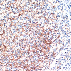 14-3-3 Protein Beta/Alpha (YWHAB) Antibody