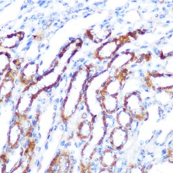 Serine/Threonine-Protein Kinase Sgk1 (SGK1) Antibody