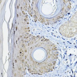 14-3-3 Protein Sigma (SFN) Antibody