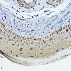 14-3-3 Protein Sigma (SFN) Antibody