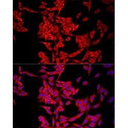 Methylthioadenosine Phosphorylase (MTAP) Antibody