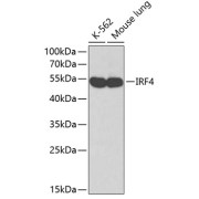 Western blot analysis of various lysates using IRF4 Antibody. Secondary antibody: HRP-conjugated Goat anti-Rabbit IgG (H+L) at 1/10000 dilution. Lysates/proteins: 25 µg per lane. Blocking buffer: 3% nonfat dry milk in TBST.