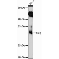 Snail Family Transcriptional Repressor 2 / SLUG (SNAI2) Antibody
