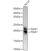 Western blot analysis of lysates from NCCIT cells, using TDGF1 Antibody at 1/900 dilution. Secondary antibody: HRP-conjugated Goat anti-Rabbit IgG (H+L) at 1/10000 dilution. Lysates/proteins: 25 µg per lane. Blocking buffer: 3% nonfat dry milk in TBST. Exposure time: 60s.