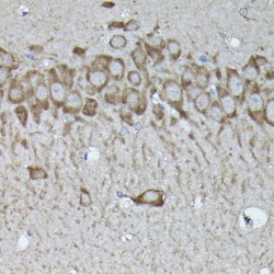 Calreticulin (CALR) Antibody