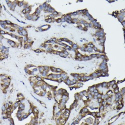 Calreticulin (CALR) Antibody