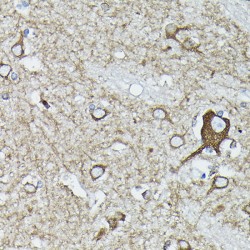 Calreticulin (CALR) Antibody