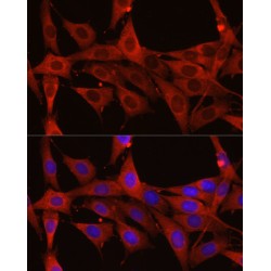 Calreticulin (CALR) Antibody