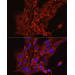 Calreticulin (CALR) Antibody