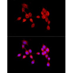 Activating Molecule In BECN1-Regulated Autophagy Protein 1 (AMBRA1) Antibody