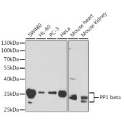 Western blot analysis of various lysates using PP1 beta Antibody at 1/1000 dilution. Secondary antibody: HRP-conjugated Goat anti-Rabbit IgG (H+L) at 1/10000 dilution. Lysates/proteins: 25 µg per lane. Blocking buffer: 3% nonfat dry milk in TBST.