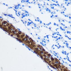 Serine/threonine-Protein Phosphatase PP1-Beta Catalytic Subunit (PPP1CB) Antibody