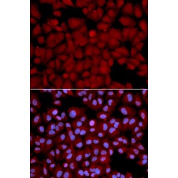 Serine/threonine-Protein Phosphatase PP1-Beta Catalytic Subunit (PPP1CB) Antibody