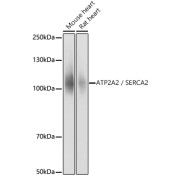 Western blot analysis of various lysates using SERCA2/ATP2A2 Antibody at 1/10000 dilution. Secondary antibody: HRP-conjugated Goat anti-Rabbit IgG (H+L) at 1/10000 dilution. Lysates/proteins: 25 µg per lane. Blocking buffer: 3% nonfat dry milk in TBST. Exposure time: 1s.